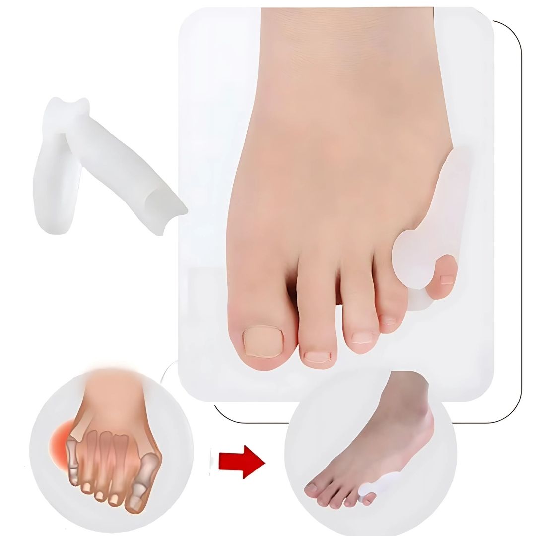 BunionGuard Exklusiv Quintus Varus | Zehenspreizer für den kleinen Zeh - Ballenschutzgel - Fehlstellungskorrektur - Schmerzlinderung