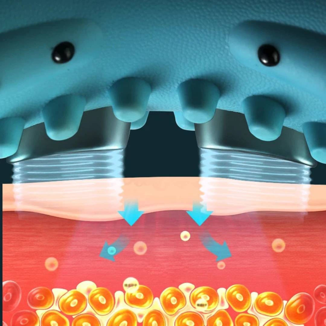 NackenEase Exklusiv EMS Nackenmassagegerät – Schmerzlinderung – Muskelstimulation – Wärmefunktion – Tragbar für Verspannungen