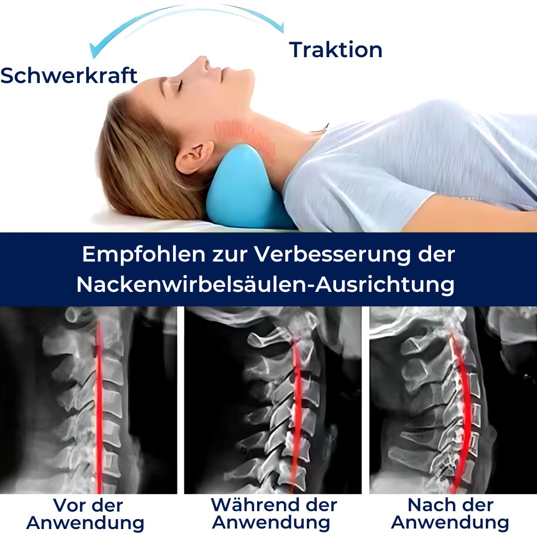 NeckAlign Exklusiv Chiropraktisches Nackenkissen | Nackenstrecker zur Schmerzlinderung, Haltungsverbesserung und besserem Schlaf