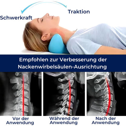 NeckAlign Exklusiv Chiropraktisches Nackenkissen | Nackenstrecker zur Schmerzlinderung, Haltungsverbesserung und besserem Schlaf